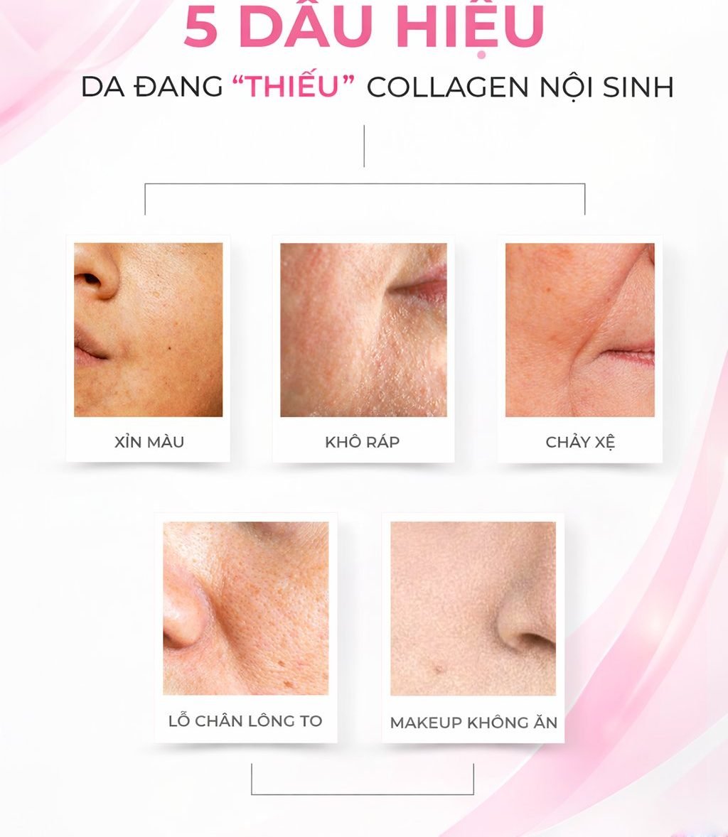 5 dấu hiệu da thiếu Collagen