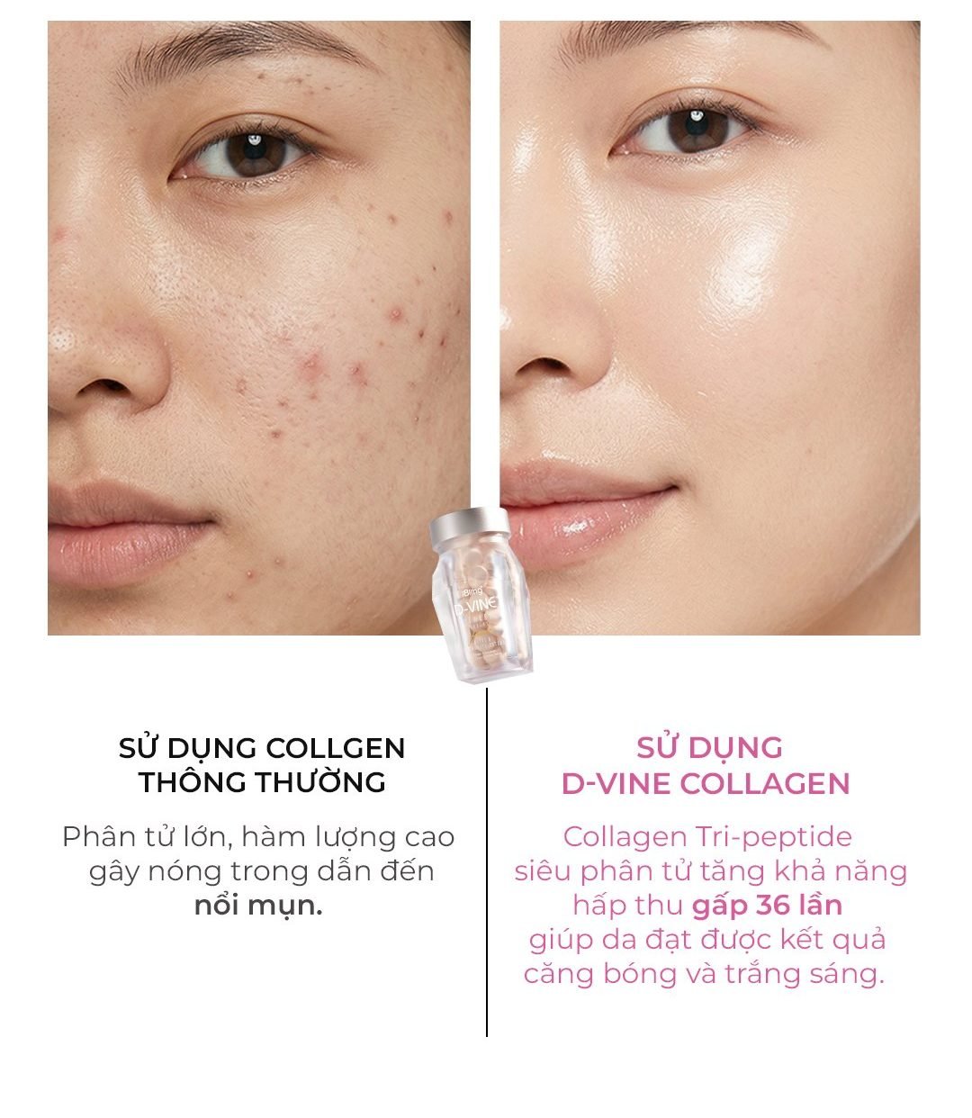 Collagen thường vs D-VINE